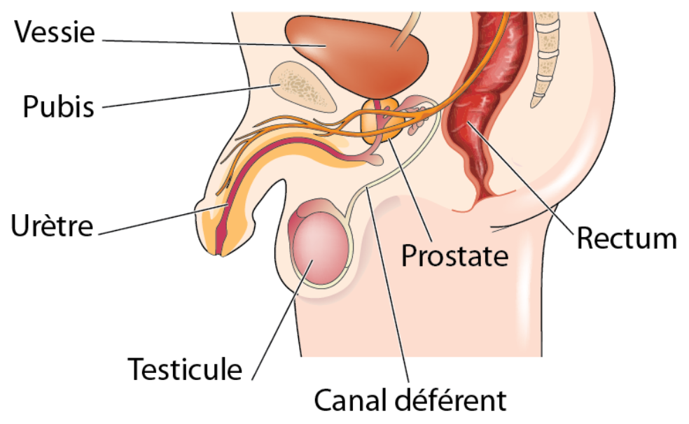 Discuții despre Cancerul de prostata